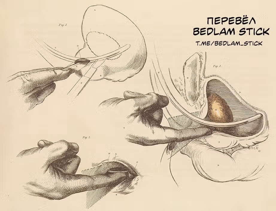 Черный Джек — Том 3 · Глава 100, страница 20